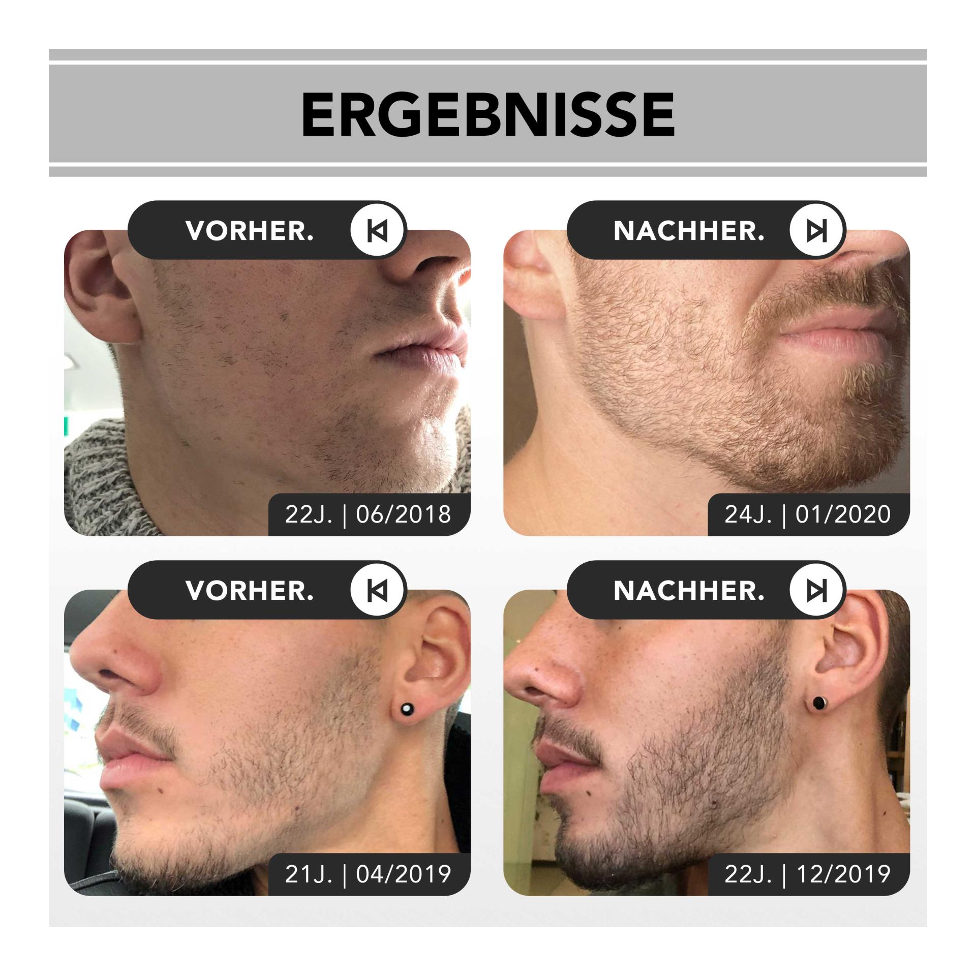 Beard Growth Kit Beard Growth Kit